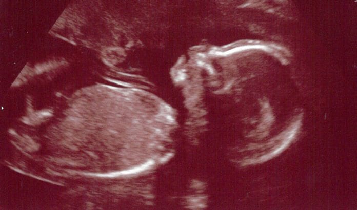 Den ene kvinnen i det lesbiske paret leverte egget, den andre gjennomførte svangerskapet som surrogatmor. (Illustrasjonsfoto: Ambernectar 13, flickr.com) Den ene kvinnen i det lesbiske paret leverte egget, den andre gjennomførte svangerskapet som surrogatmor. (Illustrasjonsfoto: Ambernectar 13, flickr.com)