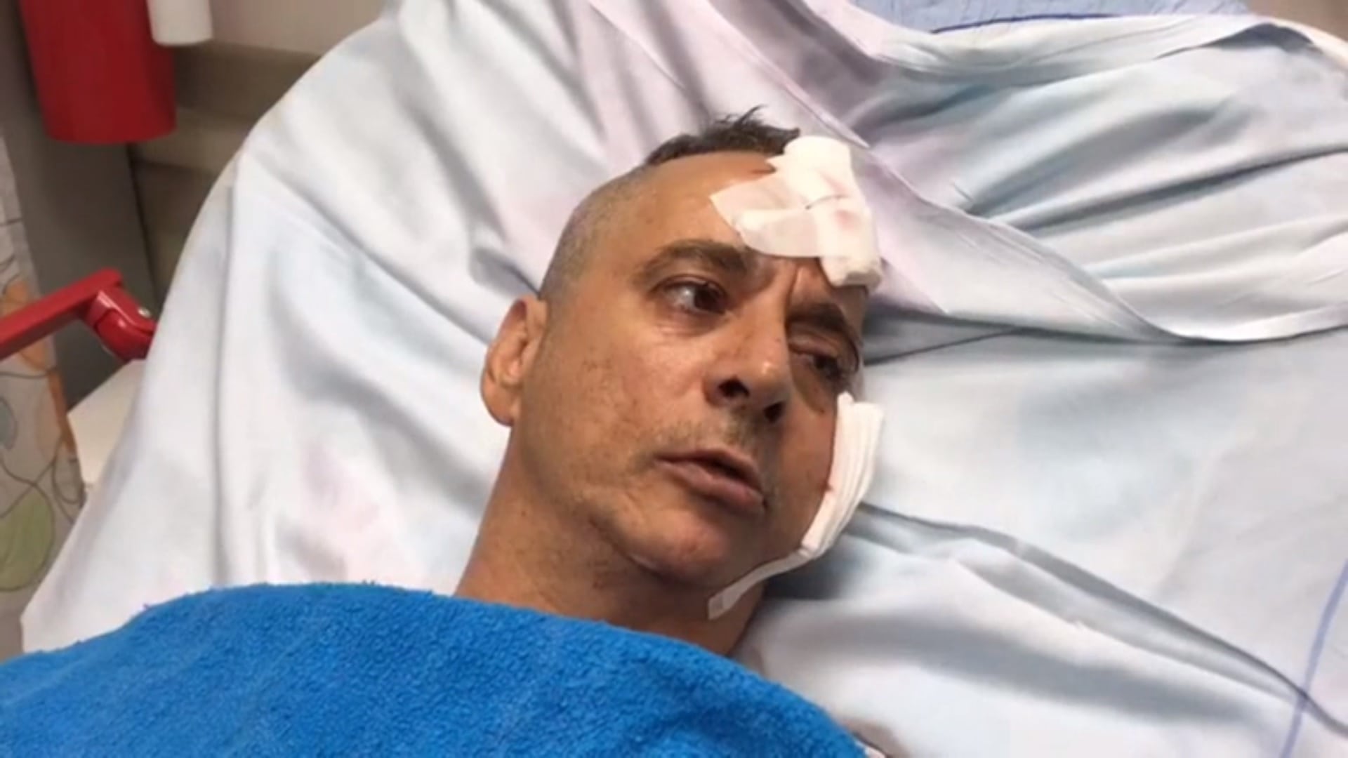 Aharon Bucharis sier det ikke var noen rakettalarm som advarte dem om det innkommende angrepet. (Foto: Barzilai Hospital Spokesperson)